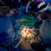 A team of surgeons transplanting a pig kidney into a brain dead patient, part of a growing field of research aimed at advancing cross-species transplants and closing the organ donor gap
